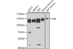 Western blot analysis of extracts of various cell lines, using CBL antibody (ABIN6131302, ABIN6138002, ABIN6138004 and ABIN6213970) at 1:1000 dilution. (CBL antibody  (AA 637-906))