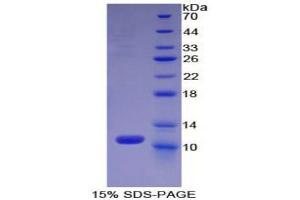 SDS-PAGE (SDS) image for Chemokine (C-C Motif) Ligand 13 (CCL13) (AA 17-98) protein (His tag) (ABIN2121634) (CCL13 Protein (AA 17-98) (His tag))