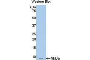 Western blot analysis of the recombinant protein. (Resistin antibody  (AA 45-114))