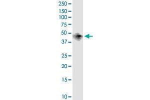BCAT1 monoclonal antibody (M02), clone 1F8. (BCAT1 antibody  (AA 1-320))
