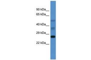 Image no. 1 for anti-COMM Domain Containing 2 (COMMD2) (AA 72-121) antibody (ABIN6746475) (COMMD2 antibody  (AA 72-121))