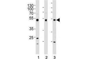 Western blot analysis of lysate from (1) HepG2, (2) HT-29, and (3) SW620 cell line using FOXA2 antibody at 1:1000. (FOXA2 antibody  (C-Term))
