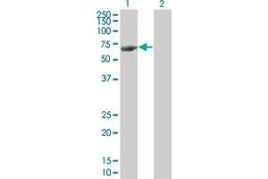 Western Blot analysis of LRIT3 expression in transfected 293T cell line by LRIT3 monoclonal antibody (M09), clone 3E7. (LRIT3 antibody  (AA 422-496))