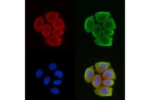 ABIN6259090 and ABIN6274229 staining Hela cells(30 min of UV treatment) by IF/ICC.