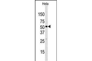 Western blot analysis of anti-JMJD2D (C-term) Pab in Hela cell line lysate.