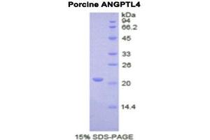 SDS-PAGE (SDS) image for Angiopoietin-Like 4 (ANGPTL4) (AA 227-389) protein (His tag) (ABIN2120584)