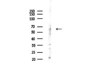 anti-Glutamic Pyruvate Transaminase (Alanine Aminotransferase) 2 (GPT2) (Internal Region) antibody