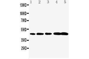 Anti-Caspase-1(P20) antibody, Western blotting Lane 1: Rat Brain Tissue Lysate Lane 2: Rat Spleen Tissue Lysate Lane 3: Mouse Brain Tissue Lysate Lane 4: Mouse Spleen Tissue Lysate Lane 5: Mouse Testis Tissue Lysate (Caspase 1 antibody  (N-Term))