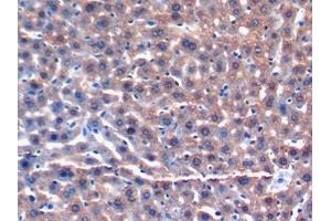 Detection of GSTa3 in Mouse Liver Tissue using Polyclonal Antibody to Glutathione S Transferase Alpha 3 (GSTa3) (GSTA3 antibody  (AA 1-221))