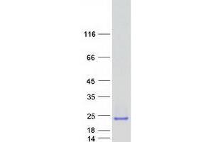 Validation with Western Blot (CRYGD Protein (Myc-DYKDDDDK Tag))