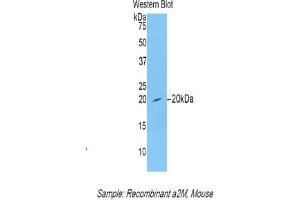 Western blot analysis of recombinant Mouse a2M.