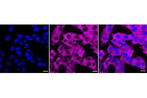 Immunocytochemical staining of HT- cells with PKC alpha antibody (ABIN7799989), 1:1,000).