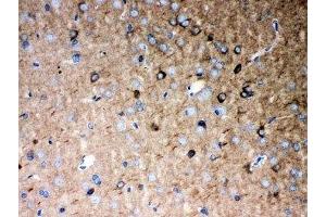 IHC-P: P2X5 antibody testing of rat brain tissue (P2RX5 antibody  (AA 333-422))