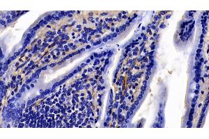 Immunohistochemistry (IHC) image for anti-Caveolin 1, Caveolae Protein, 22kDa (CAV1) (AA 2-104) antibody (ABIN7431323)