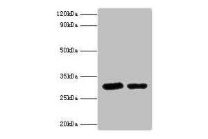 Western blot All lanes: Syntaxin-6 antibody at 2 μg/mL Lane 1: Mouse brain tissue Lane 2: 293T whole cell lysaye Secondary Goat polyclonal to rabbit IgG at 1/10000 dilution Predicted band size: 29 kDa Observed band size: 29 kDa (Syntaxin 6 antibody  (AA 4-231))