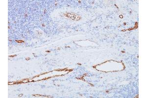 Formalin-fixed, paraffin-embedded human Tonsil stained with vWF Mouse Monoclonal Antibody (3E2D10). (VWF antibody  (AA 845-949))