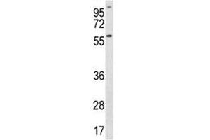 ETV5 antibody western blot analysis in A549 lysate (ETV5 antibody  (AA 8-37))