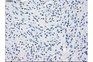 Image no. 1 for anti-Fc Fragment of IgG, Low Affinity IIa, Receptor (CD32) (FCGR2A) antibody (ABIN1497264) (FCGR2A antibody)