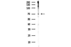 Western blot analysis of lysates from COLO205 cells(UV,30 min treatment), using Phospho-AMPK alpha 1 (Ser486) Antibody at 1/1000 dilution.