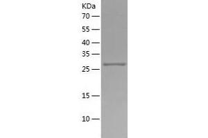 Western Blotting (WB) image for Chromosome 1open Reading Frame 89 (C1orf89) (AA 1-258) protein (His tag) (ABIN7122387) (RSG1 Protein (AA 1-258) (His tag))