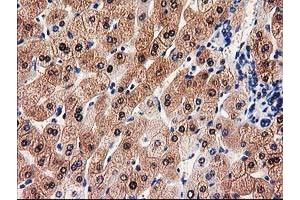 Image no. 3 for anti-UDP-Galactose-4-Epimerase (GALE) antibody (ABIN1498366)