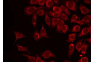 ABIN6266879 staining HepG2 by IF/ICC. (MAGEA1 antibody  (C-Term))