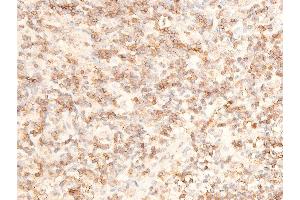 ABIN6267236 at 1/100 staining human appendiceal tissue sections by IHC-P. (MAP3K7 antibody  (pThr187))