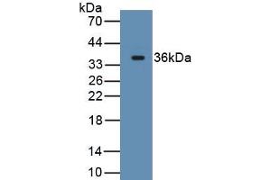 Detection of Recombinant CD163, Rat using Monoclonal Antibody to Cluster Of Differentiation (CD163) (CD163 antibody  (AA 693-939))