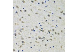 Immunohistochemistry of paraffin-embedded rat brain using CLIC1 antibody (ABIN2561895) at dilution of 1:100 (40x lens).