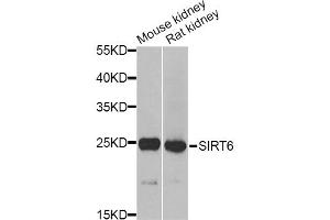 Western blot analysis of extracts of various cell lines, using MSRA Antibody. (MSRA antibody)