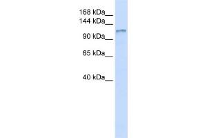 WB Suggested Anti-DGKH Antibody Titration:  0. (DGKH antibody  (Middle Region))
