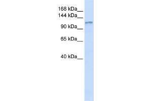 WB Suggested Anti-DGKH Antibody Titration:  0. (DGKH antibody  (Middle Region))