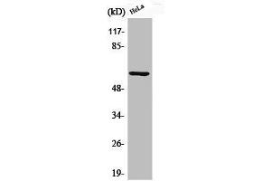 Western Blot analysis of HeLa cells using Phospho-Akt1 (S246) Polyclonal Antibody (AKT1 antibody  (pSer246))