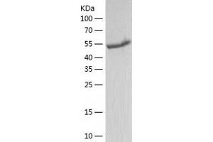 Western Blotting (WB) image for Aldehyde Dehydrogenase 5 Family, Member A1 (ALDH5A1) (AA 48-535) protein (His tag) (ABIN7121776) (ALDH5A1 Protein (AA 48-535) (His tag))