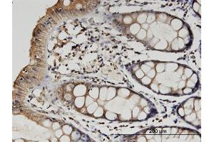 Immunoperoxidase of monoclonal antibody to TUBB2A on formalin-fixed paraffin-embedded human colon. (TUBB2A antibody  (AA 1-445))