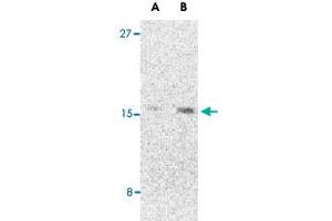 Western blot analysis of CBLN1 in 293 cell lysate with CBLN1 polyclonal antibody  at (A) 2 and (B) 4 ug/mL . (CBLN1 antibody  (C-Term))