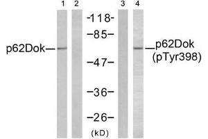 Western blot analysis of extracts from K562 cells, using p62Dok (Ab-398) antibody (E021269, Lane 1 and 2) and p62Dok (phospho-Tyr398) antibody (E011277, Lane 3 and 4). (DOK1 antibody  (pTyr398))