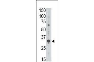 Antibody is used in Western blot to detect MAGEA3 in Jurkat lysate. (MAGEA3 antibody  (C-Term))