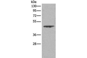 Western blot analysis of A431 cell lysate using ASS1 Polyclonal Antibody at dilution of 1:350 (ASS1 antibody)
