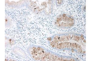Image no. 1 for anti-Chemokine (C-C Motif) Ligand 15 (CCL15) antibody (ABIN464833) (CCL15 antibody)