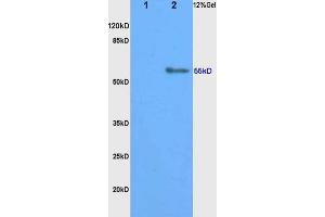 L1 rat kidney, L2 rat brain lysates probed (ABIN750823) at 1:200 in 4 °C. (CYP11B1 antibody  (AA 301-400))