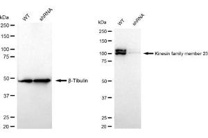 Western blotting analysis using Kinesin family member 23 antibody (ABIN7799204).