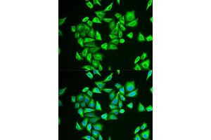 Immunofluorescence analysis of U2OS cells using PGM1 antibody (ABIN5973725). (Phosphoglucomutase 1 antibody)