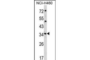 Western blot analysis of CER1 Antibody (N-term) (ABIN390938 and ABIN2841136) in NCI- cell line lysates (35 μg/lane).