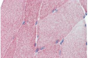 Human Skeletal Muscle (formalin-fixed, paraffin-embedded) stained with TEAD4 antibody ABIN462208 followed by biotinylated goat anti-rabbit IgG secondary antibody ABIN481713, alkaline phosphatase-streptavidin and chromogen. (TEAD4 antibody  (C-Term))