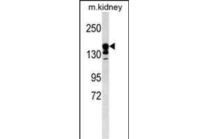 ABCC9 Antibody (Center) (ABIN1538549 and ABIN2849844) western blot analysis in mouse kidney tissue lysates (35 μg/lane). (ABCC9 antibody  (AA 640-669))