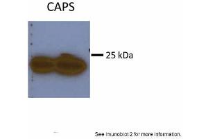 Sample Type: Huh7 HepG2 (50ug)Primary Antibody Dilution:1:500Image Submitted By: Partha KasturiUniversity of Kansas Medical Center (Calcyphosine antibody  (N-Term))