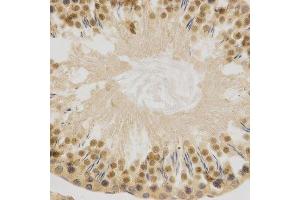 Immunohistochemistry (Paraffin-embedded Sections) (IHC (p)) image for anti-ELAV (Embryonic Lethal, Abnormal Vision, Drosophila)-Like 1 (Hu Antigen R) (ELAVL1) (AA 1-326) antibody (ABIN3022231)