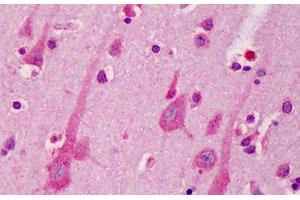 Human Brain, Cortex: Formalin-Fixed, Paraffin-Embedded (FFPE) (A1BG antibody  (AA 123-172))