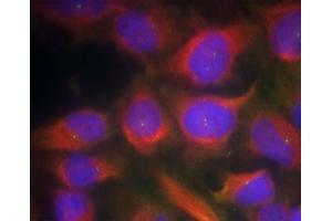 Immunofluorescence staining of methanol-fixed HeLa cells using NMDAR1 (Ab-897) Antibody (E021287, Red) (GRIN1/NMDAR1 antibody)